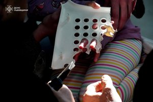 У Львові надзвичайники допомогли дівчинці, яка під час гри застрягла пальчиками у кріслі