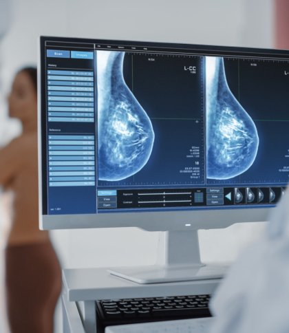 Львів’янок запрошують на мамографію у вихідні: коли і де пройти обстеження